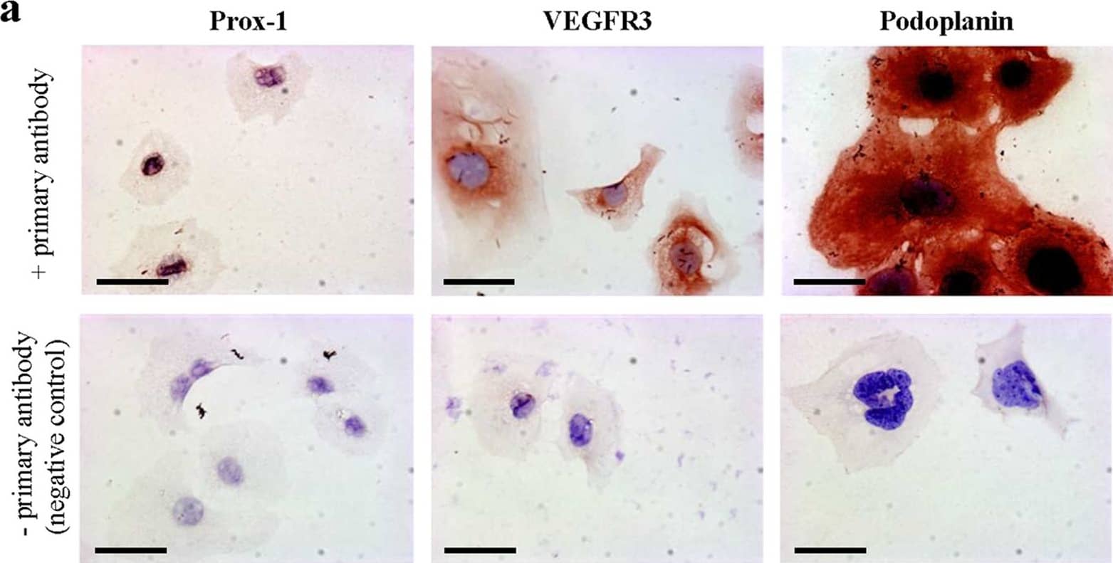 Cultured murine LECs express VDR.To check lymphatic origin of mouse LECs, we used three different well-established markers expressed by LECs. (a) Lymphatic origin of murine LECs was confirmed by IHC for Prox-1, VEGFR3 and Podoplanin (400x). Scale bar: 50 μm. (b) VDR expression of in vitro grown murine LECs was evaluated by western blot. Murine renal tubular epithelial cells (MTCs) served as positive control. (c) VDR expression of murine LECs was assessed by immunofluorescence (antibody D6) staining (200x). Scale bar: 50 μm. Image collected and cropped by CiteAb from the following publication (//pubmed.ncbi.nlm.nih.gov/28303937), licensed under a CC-BY license. Not internally tested by R&D Systems.