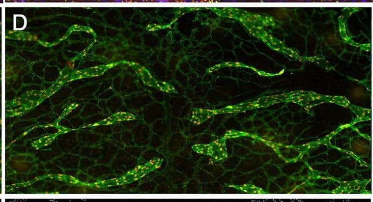 YAP and TAZ are required for the maintenance of LVs. The lymphatic vessels in the dorsal skin of E16.5 and E18.5 control and Lyve1-Cre;Yapf/f;Tazf/f embryos were analyzed by whole-mount immunohistochemistry. (A,B) LVs were observed in the collecting lymphatic vessels of E16.5 control and Lyve1-Cre;Yapf/f;Tazf/f embryos (arrows). (C,D) The migrating front of E16.5 control (C) and Lyve1-Cre;Yapf/f;Tazf/f (D) embryos appeared comparable. (E-G) At E18.5, the lymphatic vessels from the left and right sides have merged to form a network in control embryos (E). In contrast, huge gaps were observed in between the migrating fronts of E18.5 Lyve1-Cre;Yapf/f;Tazf/f embryos (F, magenta lines). The lymphatic vessels of mutant embryos were also dilated. The distance between the migrating fronts and the diameter of vessels are quantified in G. (H,I) LVs were observed in the collecting lymphatic vessels of E18.5 control embryos (H, yellow arrows). In contrast, the dilated lymphatic vessels of E18.5 Lyve1-Cre;Yapf/f;Tazf/f embryos lacked LVs (I). The various parameters of lymphatic vascular patterning were quantified and are plotted in G. n=4 embryos per each genotype. ****P<0.0001. Data are mean±s.e.m. Scale bars: 200 µm in A-D; 500 µm in E,F; 200 µm in H,I. Image collected and cropped by CiteAb from the following publication (//pubmed.ncbi.nlm.nih.gov/33060128), licensed under a CC-BY license. Not internally tested by R&D Systems.