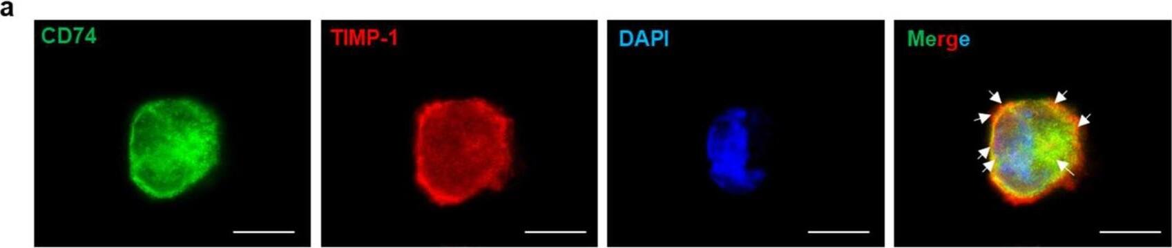 Immunocytochemistry/ Immunofluorescence CD74 Antibody [Unconjugated]