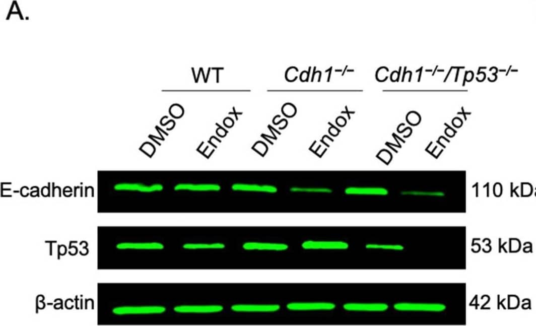 Western Blot E-Cadherin Antibody [Unconjugated]