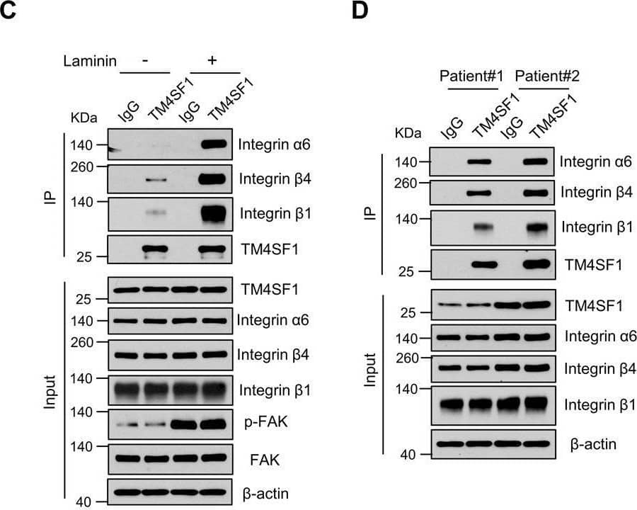 Laminin promotes the interaction between TM4SF1 and integrin  alpha 6 in Eca109 cells.A Con- and TM4SF1 overexpressed- Eca109 cell lysates (under laminin-coating condition) were immunoblotted by anti-p-FAK, anti-FAK, anti-p-PI3K p85 (Try458), anti- PI3K p85, anti-pAKT, and anti-AKT antibodies. B List of TM4SF1-associated cell membrane proteins in Eca109 cells under laminin-coating condition, identified by mass spectrometric analysis. C Co-IP of endogenous TM4SF1 with endogenous integrin  alpha 6,  beta 4, and  beta 1 in cell lysate. TM4SF1 was immunoprecipitated from Eca109 cells, which were cultured on the dishes with or without laminin-coating, and immunoblotted with antibodies against integrin  alpha 6,  beta 4,  beta 1, and TM4SF1. The input was immunoblotted with antibodies against integrin  alpha 6,  beta 4,  beta 1, p-FAK, FAK, TM4SF1, and  beta -actin. D Co-IP of endogenous TM4SF1 with endogenous integrin  alpha 6,  beta 4, and  beta 1 in ESCC patient tissues. TM4SF1 was immunoprecipitated from homogenized ESCC patient tissues lysate and immunoblotted with antibodies against integrin  alpha 6,  beta 4,  beta 1, and TM4SF1. Image collected and cropped by CiteAb from the following open publication (//pubmed.ncbi.nlm.nih.gov/35835740), licensed under a CC-BY license. Not internally tested by R&D Systems.