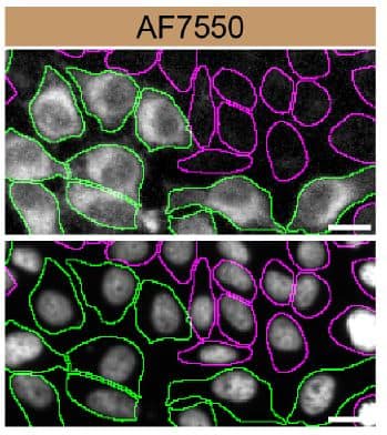 HeLa WT and SCD-1 KO cells were labelled with a green or a far-red fluorescent dye, respectively. Cells were stained with Sheep Anti-Human SCD-1 Antigen Affinity-purified Polyclonal Antibody (Catalog # AF7550) followed by incubation with an anti-sheep Alexa-fluor 555 coupled secondary antibody (upper panel). DAPI-only counterstained cells shown on a lower panel.  Acquisition of the blue (nucleus-DAPI), green (identification of WT cells), red (antibody staining) and far-red (identification of KO cells) channels was performed. Representative images of the blue and red (grayscale) channels are shown. WT and KO cells are outlined with green and magenta dashed line, respectively. Primary antibody concentration used: 1 µg/mL. Image, protocol and testing courtesy of YCharOS Inc. (ycharos.com).