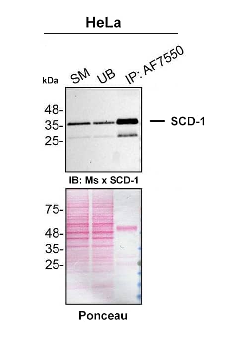 PMA-treated HeLa lysates were prepared and immunoprecipitation was performed using 2.0 µg of Sheep Anti-Human SCD-1 Antigen Affinity-purified Polyclonal Antibody (Catalog # AF7550) pre-coupled to Dynabeads protein G. Immunoprecipitated SCD-1 was detected with Mouse Anti-SCD-1 Antibody.The Ponceau stained transfer of the blot is shown. SM=4% starting material; UB=4% unbound fraction; IP=immunoprecipitate; HC=antibody heavy chain. Image, protocol and testing courtesy of YCharOS Inc. (ycharos.com).