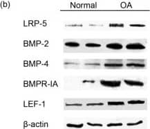 Low-density-lipoprotein receptor-related protein (LRP)-5, BMP-2, BMP-4, BMP-7, BMPR-IA, BMPR-IB, LRP-6, phospho-beta -catenin, LEF-1, and TCF-4 expression in normal and osteoarthritic chondrocytes. (a) Quantitative LRP-5, BMP-2, BMP-4, BMP-7, BMPR-IA, BMPR-IB, LRP-6, LEF-1, and TCF-4 expression in normal and osteoarthritic chondrocytes. The results showed that LRP-5 (fourfold), BMP-2 (fourfold), BMP-4 (threefold), BMPR-IA (twofold), and LEF-1 (4.5-fold) mRNA expression was significantly increased in osteoarthritic chondrocytes compared with normal. (Error bars, SEM; standard errors, *P < 0.05). (b) LRP-5, BMP-2, BMP-4, BMPR-IA, and LEF-1 protein expression in normal and osteoarthritic chondrocytes after Western blot analysis. The results showed that LRP-5, BMP-2, BMP-4, BMPR-IA, and LEF-1 protein expression was significantly increased in osteoarthritic chondrocytes compared with normal.  beta -actin was used as internal control. (c) Bar graph showing the LRP-5, BMP-2, BMP-4, BMPR-IA, and LEF-1 protein levels in normal (n = 5) and osteoarthritic chondrocytes (n = 11). (Error bars, SEM; standard errors, *P < 0.05). (d) Expression of BMP-2 in normal and osteoarthritic cartilage after immunohistochemistry experiments. (e) Western blot analysis showed a significant reduction of phospho-beta -catenin protein levels in osteoarthritic chondrocytes compared with normal. (f) Bar graph showing the phospho-beta -catenin protein levels in normal (n = 5) and osteoarthritic chondrocytes (n = 11). (Error bars, SEM; *P < 0.05). Image collected and cropped by CiteAb from the following open publication (//pubmed.ncbi.nlm.nih.gov/22513174), licensed under a CC-BY license. Not internally tested by R&D Systems.