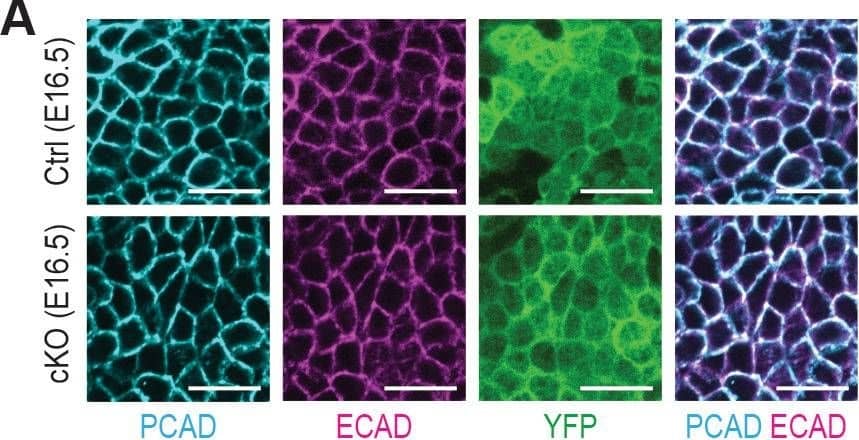 Immunohistochemistry P-Cadherin Antibody [Unconjugated]