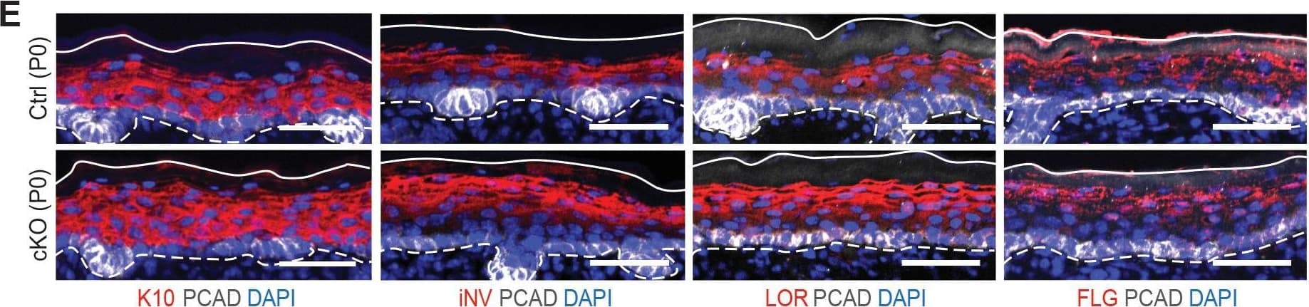 Immunohistochemistry P-Cadherin Antibody [Unconjugated]