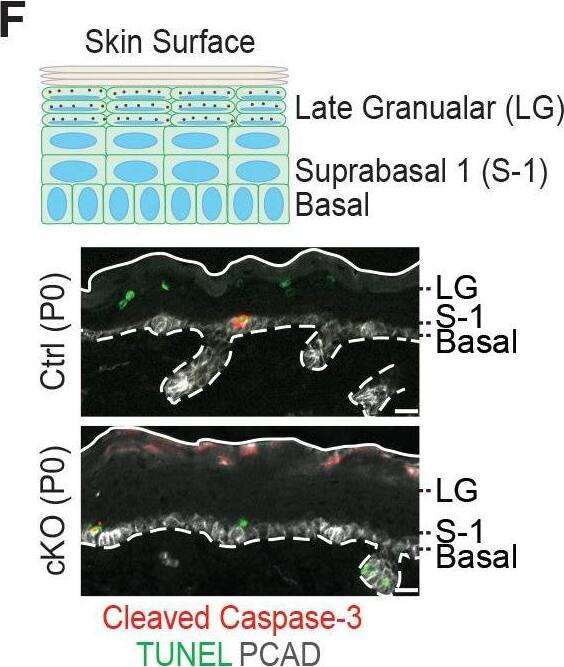 Additional analysis of epidermal perturbations upon Mettl3 cKO. (F) Representative images of P0 back skin sagittal sections with cleaved Caspase-3 immunostaining&TUNEL staining (scale bars: 20 µm). White solid lines indicate skin surface&dashed lines indicate dermal-epithelial border. Quantification of TUNEL+&cleaved Caspase-3+ cells in the designated layers at P0. Only double-positive cells denote apoptosis; TUNEL+ only cells are typically seen as granular cells lose their nuclei&transition as dead flattened cells to the stratum corneum. This is defective in Mettl3 cKO skin. The TUNEL+ cells in the suprabasal 1 layer likely correspond to the occasional cytolytic suprabasal cells that we saw at the ultrastructural level (not shown). Quantification of the labeled cells is shown (error bars: standard deviation, for each condition n = 3 biological replicates × 10 images per replicate, *p<0.05 and **p<0.01 by unpaired two-tailed Student’s t-test).Figure 6—figure supplement 2—source data 1.Quantification of PCAD, ECAD immunofluorescence signals in (A).Figure 6—figure supplement 2—source data 2.Quantification of EdU+ cells&the suprabasal/basal cell number ratio in (B).Figure 6—figure supplement 2—source data 3.Quantification of cell sizes by cytospin in (C).Figure 6—figure supplement 2—source data 4.Quantification of cell death events in epidermis in (F).Quantification of PCAD, ECAD immunofluorescence signals in (A).Quantification of EdU+ cells&the suprabasal/basal cell number ratio in (B).Quantification of cell sizes by cytospin in (C).Quantification of cell death events in epidermis in (F). Image collected & cropped by CiteAb from the following open publication (//pubmed.ncbi.nlm.nih.gov/32845239), licensed under a CC-BY license. Not internally tested by R&D Systems.