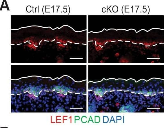 Immunohistochemistry P-Cadherin Antibody [Unconjugated]