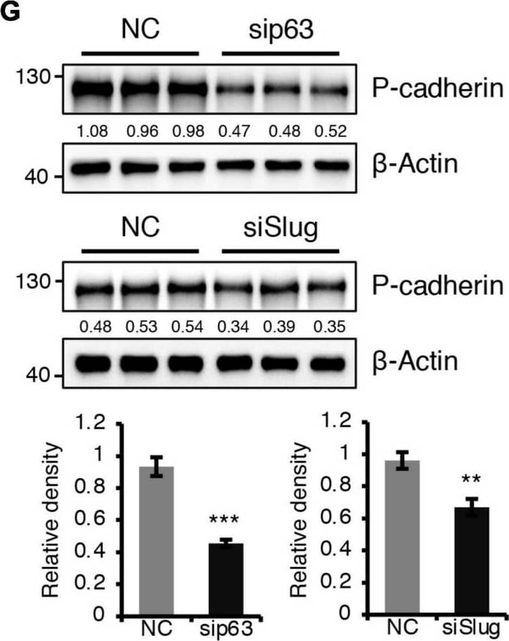 BMPR1a regulated P-cadherin expression via p63 and Slug. (A) Immunohistochemistry staining for P-cadherin in control (n = 4 mice) and cKO (n = 3 mice) mammary glands at pregnancy day 14.5. Scale bar, 50 μm. (B) Western blotting for P-cadherin in mammary epithelial cells isolated from control and cKO mice at pregnancy day 14.5.  beta -Tubulin was used as a loading control. Statistical analysis the expression of P-cadherin/ beta -Tubulin. n = 3 mice. (C) qRT-PCR analysis of Cdh3 in FACS-sorted control and cKO myoepithelial cells at pregnancy day 14.5. n = 4 biological replicates. (D) P-cadherin (red) and K14 (green) double immunofluorescence staining in HC11 mammary epithelial cells treated with BMP4 (50 ng/mL) for 24 h. n = 3 biological replicates. Scale bar, 25 μm. (E) Western blotting for P-cadherin in HC11 mammary epithelial cells treated with BMP4 (50 ng/mL) for 24 h.  beta -Tubulin was used as a loading control. Statistical analysis the expression of P-cadherin/ beta -Tubulin. n = 3 biological replicates. (F) Scatter plot showing the correlation between BMPR1A and CDH3 expression in mammary glands from TCGA and GTEx data. Pearson’s coefficient test was performed to assess statistical significance. (G) Western blotting for P-cadherin in HC11 cells treated with p63 siRNA (sip63)/Slug siRNA (siSlug) and scramble RNA (NC) at 48 h.  beta -Actin was used as a loading control. Statistical analysis the expression of P-cadherin/ beta -Actin. n = 3 biological replicates. (H) Immunofluorescence for P-cadherin (green) in HC11 cells treated with p63 siRNA (sip63)/Slug siRNA (siSlug) and scramble RNA (NC) at 48 h. n = 3 biological replicates. Scale bar, 25 μm. (I) Western blotting for K14, P-cadherin, p63 and Slug in HC11 cells treated with scramble RNA, p63 siRNA, Slug siRNA, or p63 siRNA and Slug siRNA at 48 h.  beta -Actin was used as a loading control. Statistical analysis the expression of K14/ beta -Actin, P-cadherin/ beta -Actin, p63/ beta -Actin and Slug/ beta -Actin. n = 3 biological replicates. Data were presented as means ± SD. ∗p < 0.05, ∗∗p < 0.01, ∗∗∗p < 0.001. Image collected and cropped by CiteAb from the following open publication (//pubmed.ncbi.nlm.nih.gov/34336839), licensed under a CC-BY license. Not internally tested by R&D Systems.