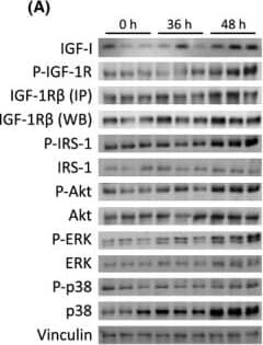 Activation of IGF signaling pathways 36 and 48 h after i.p. injection of paraquat. (A) WB detection of IGF-I from blood and of key signal transduction proteins in IGF pathways (P-tyrosine-activated forms and total protein) from lung tissue. Gel loading was controlled by vinculin. (B) Quantification of WB by chemiluminescence. Phosphotyrosine-IGF-1R (P-IGF-1R) and P-IRS-1 were detected using a phosphotyrosine-specific antibody after IP. Note that increase in IGF-1R abundance over time was very similar whether detected from IP samples or by direct WB. Tests were performed in 11- to 13-week-old mice. N = 3 per group; mean ± SEM, expressed in arbitrary units. *P < 0.05, Mann–Whitney U-test. Image collected and cropped by CiteAb from the following open publication (//pubmed.ncbi.nlm.nih.gov/23898955), licensed under a CC-BY license. Not internally tested by R&D Systems.