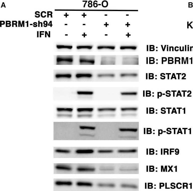 The ISGF3 is mostly unphosphorylated in 786-O ccRCC cells.786-O cells expressing SCR, PBRM1-sh94 (A) or KDM5C-sh60 (B) were mock treated or treated with interferon alpha for two hours. The SDS cellular lysates were subjected to SDS-PAGE then blotted with the indicated antibodies. Image collected and cropped by CiteAb from the following open publication (//pubmed.ncbi.nlm.nih.gov/30355451), licensed under a CC-BY license. Not internally tested by R&D Systems.