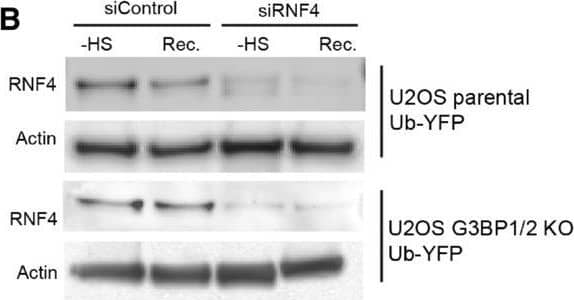 Western Blot RNF4 Antibody [Unconjugated]
