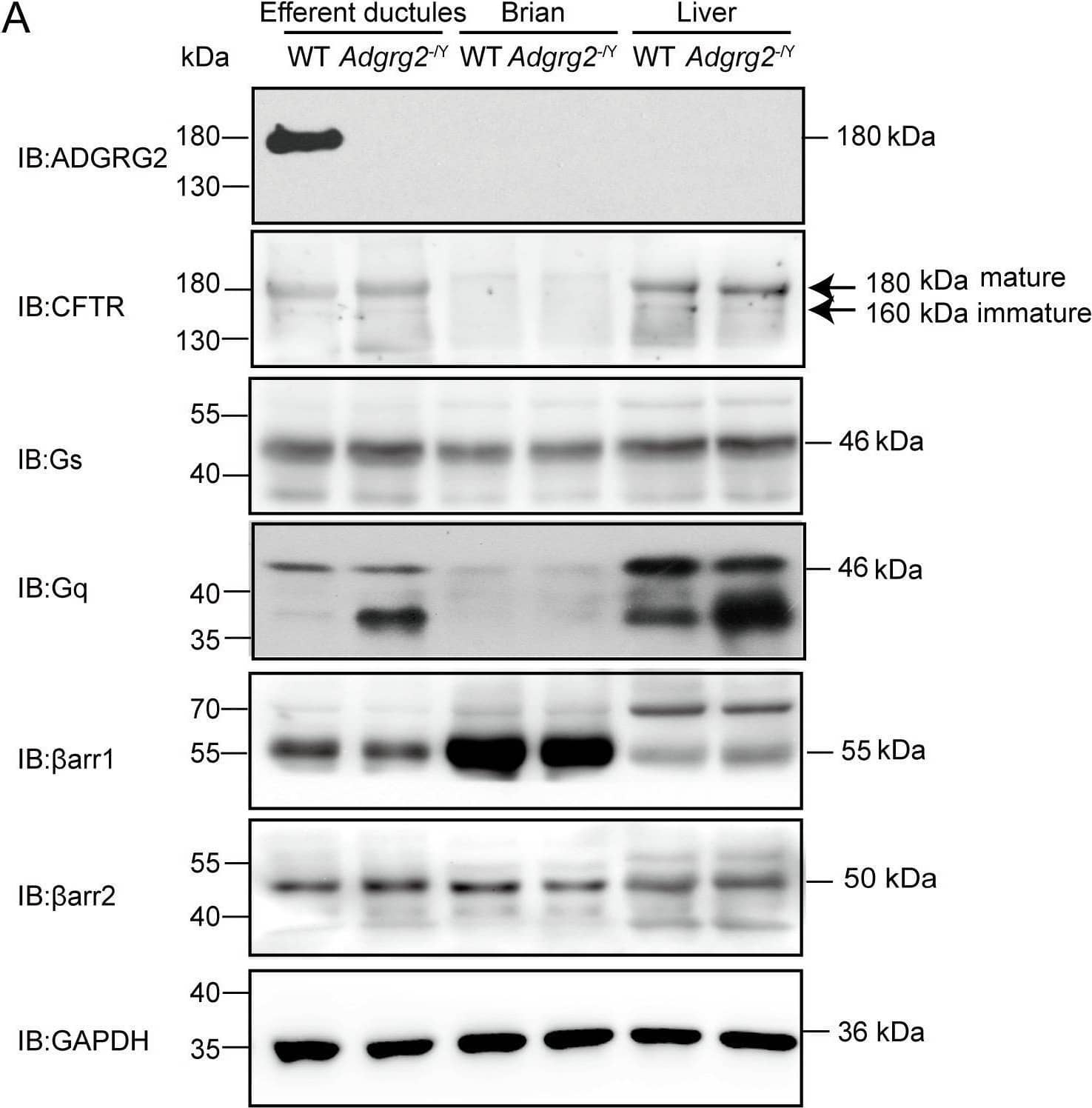 Western Blot GPR64 Antibody [Unconjugated]