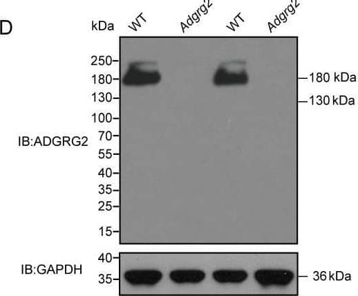 Western Blot GPR64 Antibody [Unconjugated]