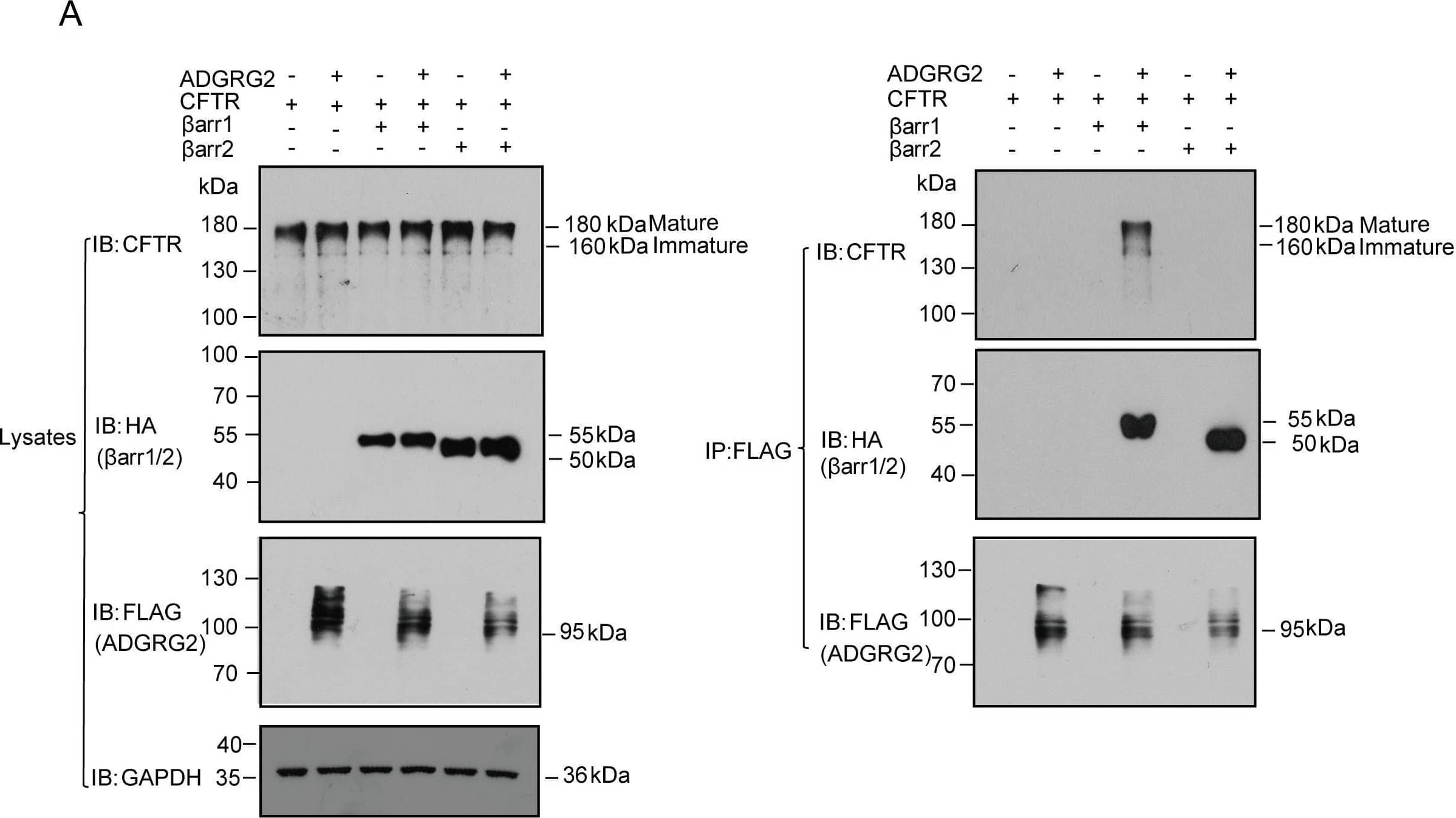 Western Blot GPR64 Antibody [Unconjugated]