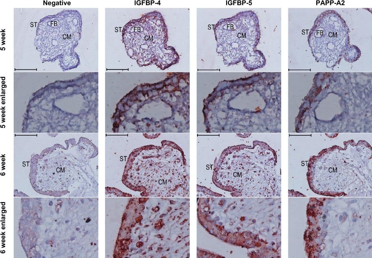 Immunoreactivity (red colour) against IGFBP-4, −5, and PAPPA2 in the syncytiotrophoblast of first trimester placental villi. Serial cross sections of placental villi at 5 and 6 weeks of gestation (7 and 13 weeks not shown) were stained for IGFBP-4, IGFBP-5, and PAPP-A2. Negative controls used non-specific goat IgG in the place of the primary antibodies. FB = fetal blood vessel, CM = chorionic mesoderm, ST = syncytiotrophoblast. Scale bars denote 100 μm. Image collected and cropped by CiteAb from the following open publication (//pubmed.ncbi.nlm.nih.gov/25475528), licensed under a CC-BY license. Not internally tested by R&D Systems.