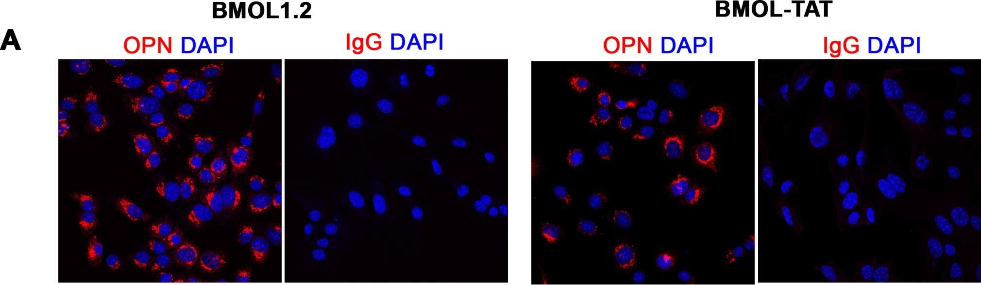 Characterisation of mouse liver progenitor cell lines.(A) Mouse liver progenitor cell (LPC) lines (BMOL1.2, BMOL-TAT) were stained using immunofluorescence to determine expression of LPC marker Osteopontin (OPN) (red). IgG isotype control images obtained using identical imaging conditions. DAPI, blue. (B) LPCs (BMOL1.2) were shown to express full-length primary cilium (Pc) structures by immunofluorescence detection of axoneme ( alpha -acetylated tubulin, green) and basal body ( gamma -tubulin, red) markers. This was also confirmed by scanning electron microscopy (SEM). BMOL-TAT cells were also confirmed to express Pc via immunofluorescence and EM studies (data not shown). (C) Nuclear GLI2 (red) expression in LPC lines (BMOL1.2, BMOL-TAT) via immunofluorescence staining. DAPI, blue. Confocal microscopy, 63x objective. Image collected and cropped by CiteAb from the following publication (//dx.plos.org/10.1371/journal.pone.0171480), licensed under a CC-BY license. Not internally tested by R&D Systems.