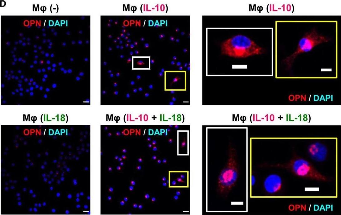 <b>Biological Strategies Validation. </b>Osteopontin (OPN) drives enhancement in macrophage (Mφ) M2 polarization and angiogenic capacity. (A) Representative images of protein expression profiles obtained by comprehensive protein array in each Mφ subset. Red arrowheads indicate OPN. (B) The mRNA expression level of Spp1 relative to glyceraldehyde-3-phosphate dehydrogenase (Gapdh) was analyzed by real-time reverse transcription polymerase chain reaction in each Mφ subset and was normalized to Mφ (–), n = 6 [***p < 0.001 vs. untreated, #p < 0.05 vs. interleukin (IL)-10 alone]. (C) The protein expression level of OPN relative to GAPDH was measured by western blotting and was normalized to Mφ (–), n = 10. Lower panels are typical images of each protein (***p < 0.001 vs. untreated, #p < 0.05 vs. IL-10 alone). (D) Representative confocal laser scanning immunofluorescence overlay images of OPN (red) and DAPI (blue) in each Mφ subset. Scale bar represents 20 µm. Images in the right row are magnified regions from white or yellow rectangles in the panels of corresponding groups. Scale bar represents 10 µm. (E) Relative mean fluorescence intensity (MFI) of CD163 was measured by FACS analysis in each Mφ subset. An anti-OPN antibody (Ab) and its isotype-matched control Ab were used at 3 µg/mL, n = 4 (***p < 0.001 vs. untreated, ##p < 0.01, #p < 0.05 vs. IL-10 alone, †††p < 0.001 vs. IL-10 + IL-18). (F) The total areas and lengths of tube-like structures were determined by the Matrigel tube formation assay where b.End5 was cocultured with each Mφ subset, n = 12 (***p < 0.001, **p < 0.01, *p < 0.05 vs. untreated, #p < 0.05 vs. IL-10 alone, †††p < 0.001 vs. IL-10 + IL-18). All data are expressed as means ± SEM and were analyzed by a one-way ANOVA followed by Tukey’s test. Image collected and cropped by CiteAb from the following publication (//pubmed.ncbi.nlm.nih.gov/29559970), licensed under a CC-BY license. Not internally tested by R&D Systems.