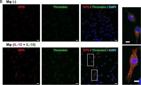 <b>Biological Strategies Validation. </b>Thrombin contributes to macrophage (Mφ) M2 polarization and angiogenic capacity through proteolytic modification for osteopontin (OPN). (A) The mRNA expression level of Prothrombin relative to glyceraldehyde-3-phosphate dehydrogenase (Gapdh) was analyzed by reverse transcription polymerase chain reaction in each Mφ subset and were normalized to Mφ (–), n = 7 [***p < 0.001, **p < 0.01 vs. untreated, ##p < 0.01 vs. interleukin (IL)-10 alone]. (B,C) The protein expression levels of (B) thrombin or (C) OPN N-Half relative to GAPDH were measured by western blotting in each Mφ subset and were normalized to Mφ (–). Lower panels are typical images of each protein. (B)n = 8 (***p < 0.001, *p < 0.05 vs. untreated, #p < 0.05 vs. IL-10 alone). (C)n = 16 (***p < 0.001, *p < 0.05 vs. untreated, ##p < 0.01, #p < 0.05 vs. IL-10 alone, †††p < 0.001 vs. IL-10 + IL-18). (D) Representative confocal laser scanning immunofluorescence images of OPN (red), thrombin (green), and their merge with DAPI (blue) in each Mφ subset. Scale bar represents 20 µm. Higher magnification images are from the white rectangle region in merged panel of Mφ (IL-10 + IL-18). Scale bar represents 10 µm. (E) Relative mean fluorescence intensity (MFI) of CD163 was measured by FACS analysis in each Mφ subset. Hirudin, a specific thrombin inhibitor, was used at 1 µg/mL, n = 3 (***p < 0.001 vs. untreated, ###p < 0.001 vs. IL-10 alone, †††p < 0.001 vs. IL-10 + IL-18). (F) The total areas and lengths of tube-like structures were determined by the Matrigel tube formation assay where b.End5 were cocultured with each Mφ subset. Hirudin was used at 1 µg/mL, n = 6 (***p < 0.001, **p < 0.01 vs. untreated, ##p < 0.01, #p < 0.05 vs. IL-10 alone, †††p < 0.001 vs. IL-10 + IL-18). All data are expressed as means ± SEM and were analyzed by a one-way ANOVA followed by Tukey’s test. Image collected and cropped by CiteAb from the following publication (//pubmed.ncbi.nlm.nih.gov/29559970), licensed under a CC-BY license. Not int