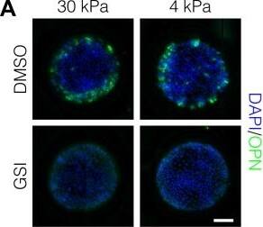<b>Biological Strategies Validation. </b>Peripheral biliary differentiation is dependent on both Notch signaling and substrate stiffness.(A) Immunolabeling for OPN of BMEL cells presented with DLL4 on 30 kPa and 4 kPa substrates. Cells were treated with vehicle control (DMSO) or an inhibitor of Notch signaling ( gamma -secretase inhibitor X, GSI, 5 µM). (B) Quantification of OPN+ cell counts on 30 kPa and 4 kPa substrates after treatment with DMSO or GSI. (C) Immunolabeling for SOX9 and HNF4A of BMEL cells on 30 kPa and 4 kPa substrates. (D) Quantification of SOX9 and HNF4A intensity on 30 kPa and 4 kPa substrates. (E) RNA in situ hybridization for Jag1, Dll1, and Notch2 on 30 kPa and 4 kPa substrates. Cells were exogenously presented with IgG or DLL4. (A, C, E) Scale bars indicate 150 µm. (B, D) Mean ± 95% CI.10.7554/eLife.38536.013Figure 2—source data 1.Summary table for OPN data in Figure 2B and Figure 2—figure supplement 1.10.7554/eLife.38536.014Figure 2—source data 2.Summary table for SOX9 and HNF4A data in Figure 2D.Summary table for OPN data in Figure 2B and Figure 2—figure supplement 1.Summary table for SOX9 and HNF4A data in Figure 2D.Quantification of OPN+ cell counts in arrayed patterns.Cells were cultured on 30 kPa and 4 kPa substrates and presented with IgG, DLL1, DLL4, and JAG1. Treatments included vehicle control (DMSO) or an inhibitor of Notch signaling ( gamma -secretase inhibitor X, GSI, 5 µM).Regression analysis of OPN+ and ALB+ cell counts.Data in Figure 2B were separated into peripheral and central subsets for which dimensionless radius was greater than 0.75 (R>0.75) and less than 0.75 (R<0.75). Separate multiple regression models were generated for each data subset for which coefficient estimates (corresponding to mean change in cell counts) and 95% CI were plotted for OPN+ (A) and ALB+ (B) cells. For each factor, 95% CI that do not intersect with the dashed line indicate regression coefficient estimates for which P<0.05. Cells were cultured on 30 kPa and 4 kPa substrates and presented with IgG, 
