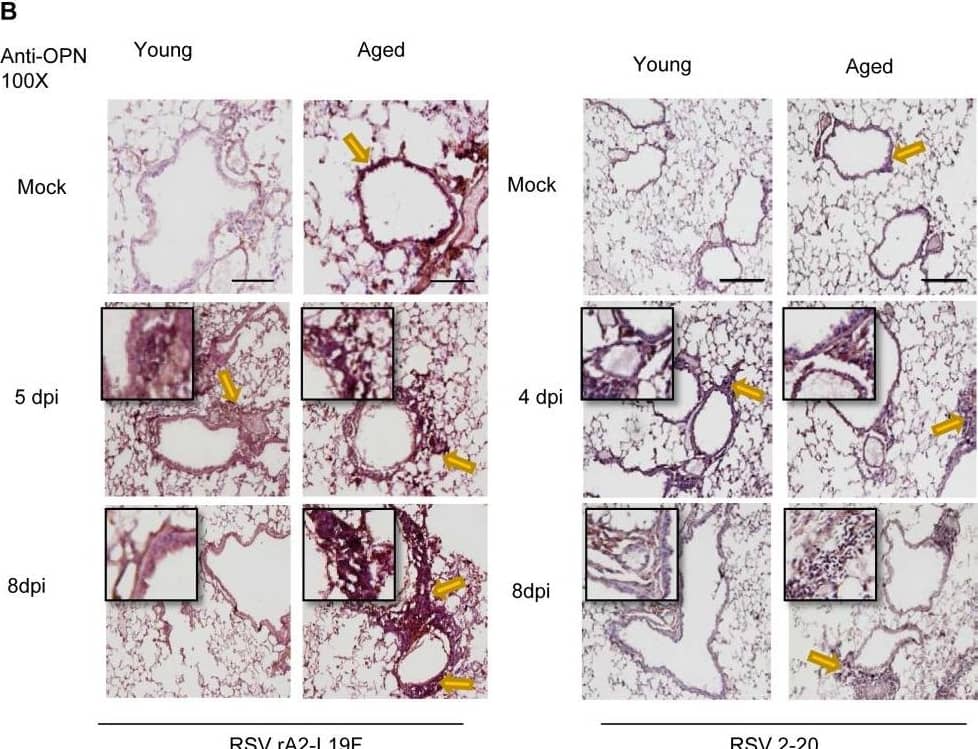 Aging results in diminished OPN production in response to 2-20 RSV infection.Young and aged BALB/c mice (n = 4/group) were intranasally infected with a dose of 106 pfu/mouse of A2 or 105 pfu/mouse of 2-20) and total lung RNA was collected on time points indicated. (A-B) RNA transcripts of OPN were analyzed with qRT-PCR and represented as a relative ratio of target gene expression to endogenous mouse HPRT and examined with rA2-L19F, 2-20, or A2. (B) 5 µm lung sections obtained at 4, 5 and 8 dpi with either rA2-L19F, 2-20, or A2 infected young and aged mice. Lung sections were immunostained for anti-mouse OPN and nickel-DAB reagent before counterstaining with hematoxylin and eosin. Representative images shown are at 100x magnification with inset [400x] displaying nickel-DAB (dark brown/black staining) positive cells and contrast the hematoxylin (light blue) nuclear stain. Representative images are shown with scale bar indicating 100 µm. (C) Enumeration of OPN-positive cells was performed with ImmunoRatio ImageJ analysis on 200X magnified lung sections from 8 dpi and values are shown as a percentage of total hematoxylin-stained cells in an individual box plot with mean interval bars. Within a single frame, at least 5 frames per mouse (n = 4/group) were collected and individual dot plots are shown of either aged or young mice with interval bars and significance, determined with ANOVA and Fisher's test (p<0.05). (D) qRT-PCR was performed on total lung RNA from young and aged 2–20 RSV infected mice for mRNA expression of OPN receptor CD44. Statistical significance was determine with ANOVA 2-way analysis with p<0.05. All experiments were performed in triplicate. Image collected and cropped by CiteAb from the following open publication (//pubmed.ncbi.nlm.nih.gov/24558422), licensed under a CC-BY license. Not internally tested by R&D Systems.