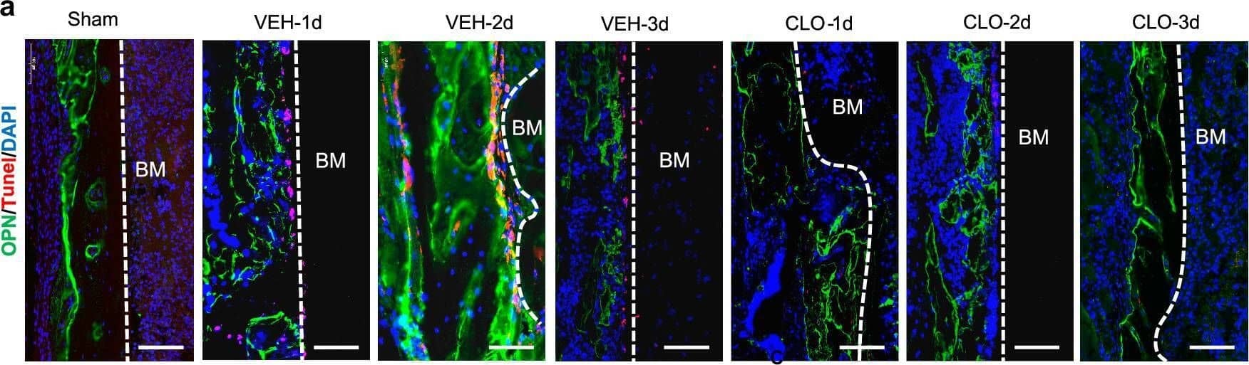 Lymphatic drainage supports osteoblast survival and BMSC proliferation. A Representative immunofluorescence staining on fracture sides using an anti-OPN antibody to label OBs (green) and an anti-tunel antibody for cell apoptosis (red). Scale bars, 50 um. b Quantitative analysis of OBs apoptosis at fracture sides (n = 5/group, one-way ANOVA). c Scheme of the experimental procedure in vitro for OBs and BMSCs treated by bone marrow or hematoma CM. Bone marrow of sham group and hematoma of fractured group were collected to generate hematoma CM. Rat BMSCs and OBs were cultured with hematoma CM for 24 h and subjected to growth and proliferation analyses. The scheme was modified from Servier Medical Art (//smart.servier.com/), licensed under a Creative Common Attribution 4.0 Generic License (//creativecommons.org/licenses/by/4.0/). d Rat OBs were intervened with hematoma CM for 1 h and OB apoptosis was evaluated by flow cytometry with FITC-Annexin V and PI double staining (n = 5/group, one-way ANOVA). e Rat OBs were cultured with hematoma CM for 1 h and the growth of rat OBs was observed under a microscope. Scale bars, 50 um. f The cell count of rat OBs cultured with hematoma CM for 24 h. g Rat OBs were cultured with hematoma CM for 24 h and the cell proliferation was evaluated using a CCK8 kit. h Rat BMSCs were cultured with hematoma CM for 1 h and the growth of rat BMSCs was observed under a microscope. Scale bars, 50 um. i The cell count of rat BMSCs cultured with hematoma CM for 24 h. j Rat BMSCs, were cultured with hematoma CM for 24 h and the cell proliferation was evaluated using a CCK8 kit. Data are means ± SD. In f,g,i and j, n = 3 wells with biological replicates in the control, sham, VEH and CLO groups, one-way ANOVA. Source data are provided as a Source Data file. Image collected and cropped by CiteAb from the following open publication (//pubmed.ncbi.nlm.nih.gov/39827193), licensed under a CC-BY license. Not internally tested by R&D Systems.