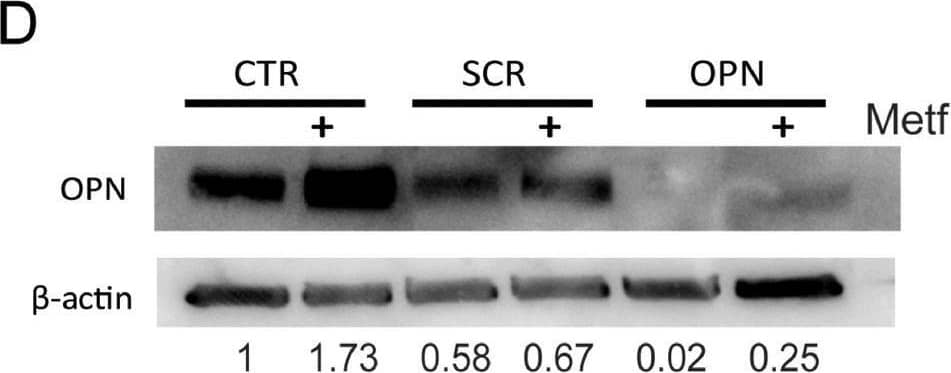 Metformin treatment increases OPN expression in preosteoblasts, contributing to an increase in adhesion of myeloma cells. (A) 2T3, MC3T3 and ST2 were treated with 5 mM metformin for 48 h and osteopontin gene expression quantified (** p < 0.01 as compared to control, n = 3–7). (B) Osteopontin protein expression following metformin treatment for 48 h in 2T3 preosteoblasts and ST2 stromal cells. (C) OPN gene expression in 2T3 preosteoblasts after transfection with either scrambled (SCR) or OPN siRNA (** p < 0.01 as compared to scrambled transfection, n = 3). (D) OPN protein expression in 2T3 preosteoblasts following transfection with OPN siRNA or scrambled control SCR and treatment with metformin. CTR = untransfected. 2T3 preosteoblasts (scrambled control (SCR) or osteopontin siRNA (OPN)) were pretreated with metformin and adhesion imaged and quantified. (E) Representative image and quantification of specific image. (F) Quantification of myeloma cell adhesion (* p < 0.05 as compared to control, n = 4). Data are presented as mean ± SEM. Image collected and cropped by CiteAb from the following open publication (//pubmed.ncbi.nlm.nih.gov/34890968), licensed under a CC-BY license. Not internally tested by R&D Systems.