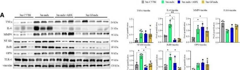Gene and protein expression in muscles from 3m mdx, mdx+ABX, and GFmdxA–KCropped images of representative WB and RT‐qPCR analysis of TA muscle of 3m mdx (n = 3/4), 3m mdx+ABX (n = 3/4), and 3m GFmdx (n = 5) showing the expression of the proteins specifically involved in inflammation/fibrosis (A), skeletal muscle metabolism (B–E), mitochondrial biogenesis (F and G), calcium conducting channels (H and I), autophagy (J), and nicotinic acetylcholine receptors (K). Densitometric data were normalized on vinculin and expressed as mean ± SD. Data are presented as mean ± SD (*P < 0.05, **P < 0.01, ***P < 0.001; ****P < 0.0001, ordinary one‐way ANOVA, Tukey's multiple‐comparison test for WB and non‐parametric test followed by Kruskal–Wallis test for RT‐qPCR).Source data are available online for this figure. Image collected and cropped by CiteAb from the following open publication (//pubmed.ncbi.nlm.nih.gov/36533294), licensed under a CC-BY license. Not internally tested by R&D Systems.