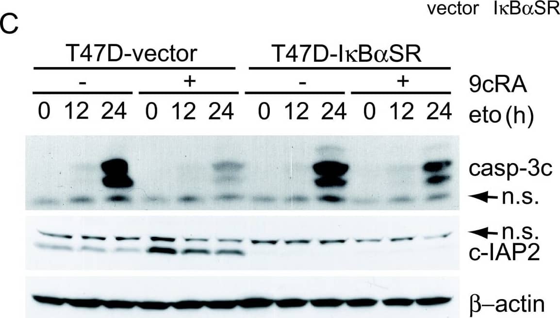 Over-expression of the super-repressor of NF-kappa B activation, I kappa B alpha -SR(S32A/S36A), leads to significant abrogation of retinoic acid-mediated inhibition of etoposide-induced apoptosis. (A) T47D-vector and T47D-I kappa B alpha SR cells were untreated or incubated for the indicated time with hTNF alpha  (50 ng/ml). Extracts were analyzed by western blotting with an I kappa B alpha  antibody. Equal loading was confirmed with an anti-beta -actin antibody. The images shown are from one representative experiment performed three times with similar results. (B) T47D-vector or T47D-I kappa B alpha SR cells were untreated or treated with 9-cis-RA for 48 h and expression of cIAP2 and  beta -actin were analysed by Reverse-Transcriptase Polymerase Reaction and real time PCR. The values represent the mean ± SD of three different experiments performed in duplicate. (C) T47D-vector or T47D-I kappa B alpha SR cells were pretreated with or without 9-cis-RA for 30 h, followed by treatment with etoposide 100 μM as previously indicated. At the indicated times, cell lysates were analyzed by western blot for the expression of cleaved caspase-3, cIAP2 and  beta -actin using specific antibodies. The images shown are from one representative experiment performed three times with similar results. (D) T47D-vector or T47D-I kappa B alpha SR cells were pretreated with or without 9-cis-RA for 30 h, followed by treatment with etoposide 100 μM for 72 h. The percentage of apoptotic cells was determined by FACS analysis after staining with propidium iodide. The values represent the mean ± SD of three independent experiments performed in duplicate. Asterisks denote the existence of statistically significant differences between the indicated groups; N.S.: not significant (Student's t-test). Image collected and cropped by CiteAb from the following open publication (//molecular-cancer.biomedcentral.com/articles/10.1186/1476-4598-9-15), licensed under a CC-BY license. Not internally tested by R&D Systems.