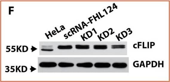 cFLIP is highly expressed in FHL124 cells and also significantly upregulated after TNF alpha  stimulation.A Anti-apoptotic protein expression in FHL124 and HeLa cell with and without TNF alpha  and TNF alpha  plus CHX stimulation. B Relative cFLIP mRNA expression in FHL124 and HeLa cells with and without TNF alpha  and CHX stimulation. FHL 124 cells demonstrated a more robust response to TNF alpha  and CHX stimulation compared to HeLa cells. C The endogenous cFLIP, Caspase-8, caspase-9, and caspase-3 mRNA levels in FHL124 cells vs. HeLa cells. A much higher cFLIP mRNA expression was seen in FHL124 cells compared to HeLa cells. D,E cFLIP protein expression after TNF alpha  and CHX stimulation in FHL124 and HeLa cells. cFLIP protein level was increased around 3-fold in FHL124 cells at 5 h after TNF alpha  and CHX stimulation, while only a mild increase was seen in HeLa cells after stimulation. F,G FHL124 cells had 6-fold endogenous cFLIP protein levels vs. HeLa cells. KD3 shRNA was able to knock down 50% of cFLIP expression in FHL124 cells. Each assay was repeated at least three times. One-way ANOVA with Tukey’s Honest post-hoc analysis was used to compare between groups, and only p < 0.05 is considered significant. *<0.05, **<0.01, ***<0.001, ****<0.0001. Image collected and cropped by CiteAb from the following open publication (//pubmed.ncbi.nlm.nih.gov/33837174), licensed under a CC-BY license. Not internally tested by R&D Systems.