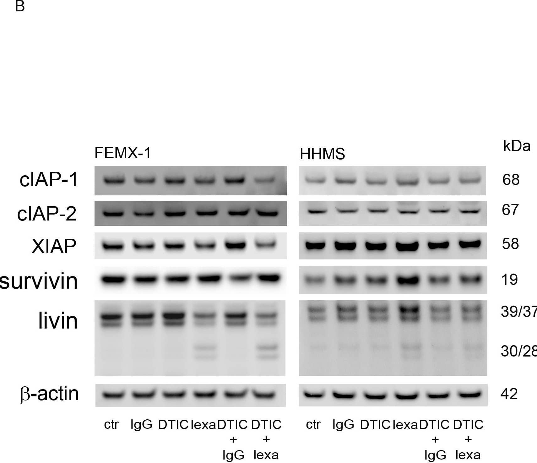 Evaluation of apoptosis regulating proteins after lexatumumab (1 µg/ml) and DTIC (50 µg/ml) treatment in FEMX-1 and HHMS.The cells were harvested 24 h after treatment exposure and analyzed for various apoptotic markers. (A) Immuno-blot detection of Bcl-w, Bcl-XL, Mcl-1, Bak, Bax, Bik, Bad, BimEL, BimL and BimS expression in FEMX-1 cells. (B) Immuno-blot detection of cIAP-1, cIAP-2, XIAP, survivin and livin in FEMX-1 and HHMS cells.  beta -actin is used as loading control. Cell lysates were prepared from three independent biological experiments, and representative blots are included in the figure. Image collected and cropped by CiteAb from the following open publication (//pubmed.ncbi.nlm.nih.gov/23029050), licensed under a CC-BY license. Not internally tested by R&D Systems.