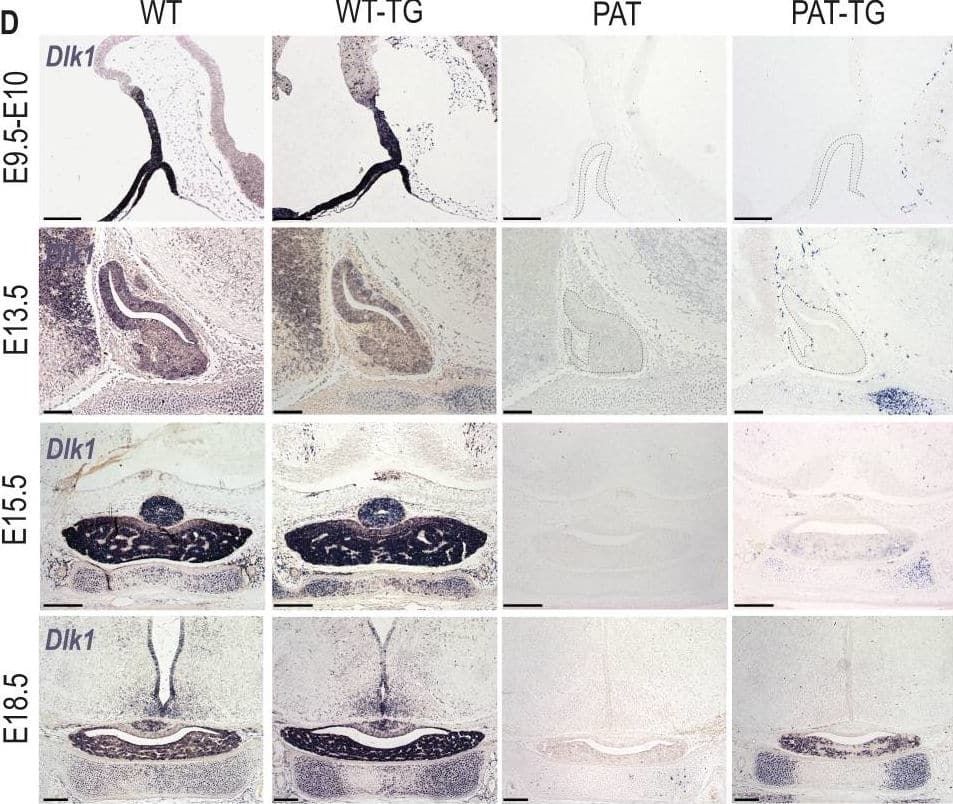 Dlk1 imprinting & expression in the developing pituitary gland from the endogenous locus & TGDlk1-70C transgene.(A) Cross used to generate embryos & postnatal animals in the study. Males inheriting the deleted allele from the mother (maternal Dlk1tm1Srbpa/+ heterozygotes or MATs) were crossed to females hemizygous for the TGDlk1-70C transgene (WT-TG), generating 4 genotypes, WT, WT-TG, paternal Dlk1+/tm1Srbpa heterozygotes (PATs) & mice inheriting a deleted paternal allele & the transgene (PAT-TG). (B) Schematic showing the known splice variants of Dlk1, A-D. Splicing occurs internally in exon 5 of the Dlk1 gene. Dlk1-A & B retain an extracellular cleavage domain (TACE), in Dlk1-C & D this region is spliced out. All versions contain a single pass transmembrane domain (TM). Red arrows indicate location of primers used in (C). (C) Semi-quantitative PCR on embryonic day (E) 18.5 whole pituitary glands from the 4 genotypes shown in (A). Top – primers amplify the exon 4–5 region of Dlk1 & can distinguish splice variants based on size. Bottom – alpha-tubulin (Tuba1a) was amplified as a loading control on each sample. (D) In-situ hybridisation for Dlk1 in the developing pituitary gland from E9.5 to E18.5 in the 4 genotypes shown in (A). Dlk1 expression is indicated by purple staining. Scale bars show 100 µm (E9.5 & E13.5, sagittal sections) & 200 µm (E15.5 & E18.5, frontal sections). (E) Immunohistochemistry (IHC) for DLK1 on frontal sections at E18.5 & postnatal day 21 (P21), counterstained with DAPI. Scale bars = 50 µm.Figure 2—source data 1.Zipped file containing the source data for Figure 2D -gels with cropped areas highlighted & original gel images. Zipped file containing the source data for Figure 2D -gels with cropped areas highlighted & original gel images. Image collected & cropped by CiteAb from the following open publication (//pubmed.ncbi.nlm.nih.gov/37589451), licensed under a CC-BY license. Not internally tested by R&D Systems.