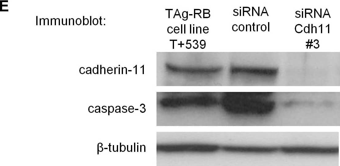 Allelic loss of Cdh11 led to faster growing tumors due to decreased cell death. (E) Cadherin-11 was knocked down using stealth siRNA in a cadherin-11 expressing cell line derived from TAg-RB tumors, T +539. Knockdown of Cdh11 clearly decreased caspase-3 expression compared to control. Image collected & cropped by CiteAb from the following open publication (//pubmed.ncbi.nlm.nih.gov/20421947), licensed under a CC-BY license. Not internally tested by R&D Systems.