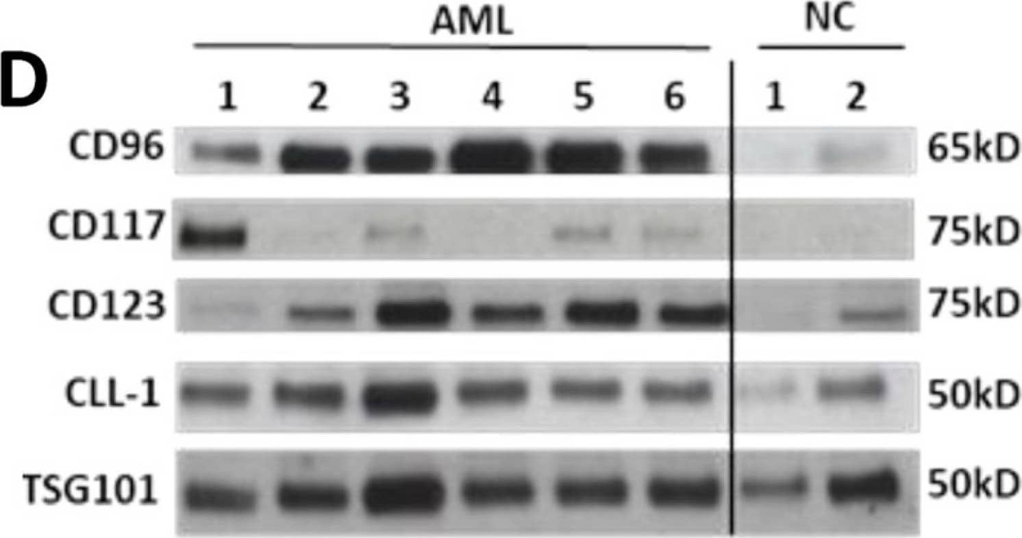Characteristics of sEV isolated from AML patients’ plasma at diagnosis: (A) transmission electron microscopy (TEM) of isolated sEV, (B) size and concentration of sEV as determined by NanoSight, (C) Western blots show that sEV carry endocytic markers (Alix, CD9, and TSG101) but not cytoplasmic proteins such as Grp94 or Calnexin, and (D) Western blots show the presence of LAAs in the isolated sEV. LAAs are differentially expressed in each patient’s sEV. Each lane was loaded with 10 μg of sEV protein. TSG101 is a marker that confirms the endocytic origin of sEV. NC: sEV isolated from healthy donors’ plasma. Image collected and cropped by CiteAb from the following open publication (//pubmed.ncbi.nlm.nih.gov/38137457), licensed under a CC-BY license. Not internally tested by R&D Systems.