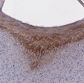 Immunohistochemistry DCC Antibody [Unconjugated]