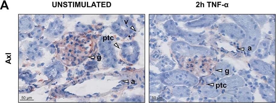 Immunohistochemistry Axl Antibody [Unconjugated]