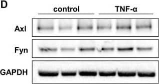 Kinase presence and activity in TNF-alpha -stimulated HUVEC. The influence of different durations of TNF-alpha  (10 ng/ml) stimulation on the phosphorylation and total protein expression of (A) p65 and (B) ERK1/2 determined in HUVEC by immunoblotting. Quantification and normalisation of phosphorylated protein to total protein is shown as fold-change to unstimulated control. (C) Selection of three kinases as potential targets based on time-course data of the mean specificity score and mean kinase statistic (see Materials and Methods). The mean specificity score is based on peptide phosphorylation patterns relative to the unstimulated control condition and represents the likelihood of a kinase to be present (gradation of red). The mean kinase statistic indicates the predicted activity of the kinase relative to untreated control (gradation from blue, less active, to red, highly active). (D) Immunoblot of total HUVEC protein lysates showing presence of Axl and Fyn in control conditions or following 2 h TNF-alpha  stimulation in HUVE. (E) Immunoblot of total HUVEC protein lysates showing absence of Lck in control conditions or following 2 h TNF-alpha  stimulation in HUVEC. n = 3 independent experiments. Image collected and cropped by CiteAb from the following open publication (//pubmed.ncbi.nlm.nih.gov/36532777), licensed under a CC-BY license. Not internally tested by R&D Systems.