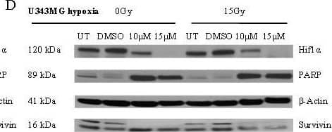 Effects of BA and irradiation on protein expression levels of glioma cells. BA treatment affects the cleavage of PARP, the expression of survivin and hypoxia-induced HIF-1 alpha  protein levels in U251MG (left) and U343MG (right) cells. Cell lines were untreated (UT), treated with DMSO or with increasing doses of BA from 10, 20 or 25 μM under normoxic conditions (A, B) and untreated (UT), treated with DMSO or with doses of 10 or 15 μM BA plus irradiation at 15 Gy under hypoxic conditions (C, D). Actin served as an internal loading control. The Western blot shows one representative result out of three independent experiments. Image collected and cropped by CiteAb from the following open publication (//pubmed.ncbi.nlm.nih.gov/21906280), licensed under a CC-BY license. Not internally tested by R&D Systems.