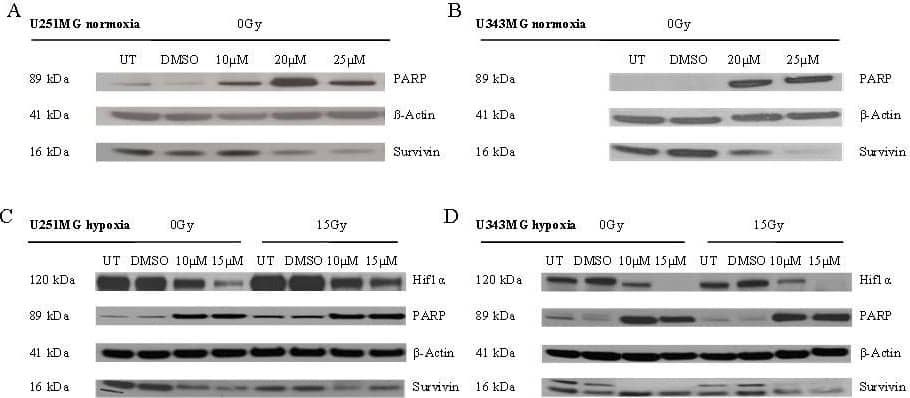 Effects of BA and irradiation on protein expression levels of glioma cells. BA treatment affects the cleavage of PARP, the expression of survivin and hypoxia-induced HIF-1 alpha  protein levels in U251MG (left) and U343MG (right) cells. Cell lines were untreated (UT), treated with DMSO or with increasing doses of BA from 10, 20 or 25 μM under normoxic conditions (A, B) and untreated (UT), treated with DMSO or with doses of 10 or 15 μM BA plus irradiation at 15 Gy under hypoxic conditions (C, D). Actin served as an internal loading control. The Western blot shows one representative result out of three independent experiments. Image collected and cropped by CiteAb from the following open publication (//pubmed.ncbi.nlm.nih.gov/21906280), licensed under a CC-BY license. Not internally tested by R&D Systems.