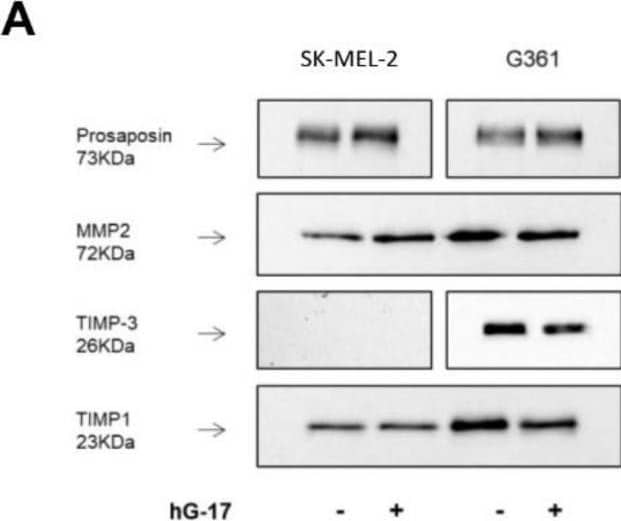 Conditioned media from G17-stimulated melanoma cells exhibit upregulation of MMP-2 and downregulation of TIMP-3 expression. Representative demonstration of the confirmation of proteomic data using Western blot analysis, with prosaposin serving as a benchmark for gastrin responsiveness (A). Mean and standard deviation (±SD) of the densitometric analysis results from three independent experiments (B). Statistical difference (* p < 0.05) between treated and untreated control groups (considered as 100%) are indicated as follows: prosaposin, TIMP-3 and TIMP-1 levels in G361 cells and MMP2 expressions in the SK-MEL-2 cell line. Image collected and cropped by CiteAb from the following open publication (//www.mdpi.com/1422-0067/24/23/16851), licensed under a CC-BY license. Not internally tested by R&D Systems.