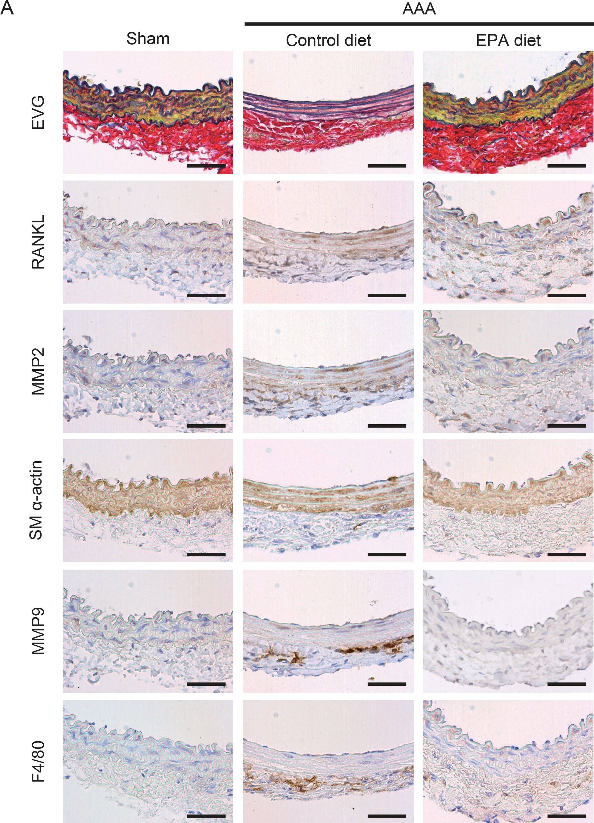 <b>Biological Strategies Validation. </b>MMP2, MMP9, and RANKL expression in AAAs.A. Immunohistochemical staining for indicated proteins of serial sections of aortas one week after CaCl2 treatment. Elastic van Gieson staining is also shown. SM  alpha -actin and F4/80 were stained to locate SMCs and macrophages, respectively. Shown are representative images of 4 or more samples in each group. Scale bars, 50 µm. B. Relative positive staining area of MMP2, MMP9, and RANKL in sections from control diet and EPA diet groups. n = 4–5. *P<0.05. Image collected and cropped by CiteAb from the following publication (//dx.plos.org/10.1371/journal.pone.0096286), licensed under a CC-BY license. Not internally tested by R&D Systems.