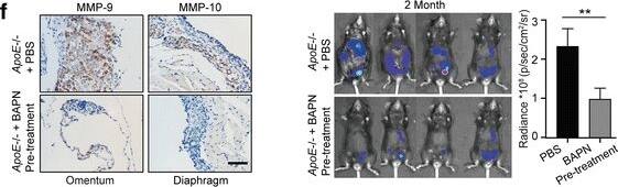 <b>Biological Strategies Validation. </b>BAPN treatment delays ovarian cancer progression by reducing adhesions. (a) Experimental design: PBS or BAPN was intraperitoneally administrated to 20-weeks-old female ApoE−/− mice each day and continued for four weeks. A cohort of mice was sacrificed for further experiments. For the remaining mice, the drug treatment was stopped for two weeks before the establishment of ID8 allografts. (b) Hydroxyproline was measured in the plasma and diaphragm. (c) Masson’s Trichrome stain after BAPN treatment (left). The positive-staining percentage of 10 random fields was calculated (right). Bar represents 50 μm. (d) Cells adhesive to the omentum were analyzed four hours after ID8 intraperitoneal injection by fluorescence microscopy (left). The adhesive cells were determined from the total fluorescent intensity after digestion (right). Bar represents 200 μm. (e) In vivo luciferase measured at two weeks (top) and two months (bottom) post establishment in ApoE−/− mice with PBS or BAPN pre-treatment. Quantification of luminescence is represented as the radiance. (f) MMP-9 expression measured by IHC in tumor lesions of ApoE−/− mice with PBS or BAPN treatment. Each experiment includes data from 4 mice. Bar represents 50 μm. *P < 0.05; **P < 0.005 Image collected and cropped by CiteAb from the following publication (//pubmed.ncbi.nlm.nih.gov/29458390), licensed under a CC-BY license. Not internally tested by R&D Systems.
