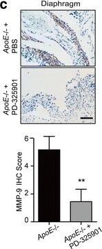 <b>Biological Strategies Validation. </b>Remodeled ECM promotes malignancy of ovarian cancer via FAK-ERK-MMP activation. (a) Specimens from Fig. 5D were immunoassayed for p-FAKY397 (red), and nuclei were stained with Hoechst (blue). (b) IHC of active ERK (p-p44/42 MAPKThr202/Tyr204) in tumor lesions from WT and ApoE−/− mice with PBS or BAPN treatment two weeks after ID8 engraftment. (c) PBS or PD-325901 was administrated to ApoE−/− mice once ID8-Luciferase cells were intraperitoneally injected and treatment continued for one month. The representative images (top) and quantification data (bottom) of MMP-9 protein expression in tumor lesions two months after ID8 engraftment. (d) In vivo luciferase expression was determined two weeks or two months post treatment. Luminescence (right panel) is represented as the radiance (p/s/cm2/sr). Each experiment included data from 4 mice. Bar represents 50 μm. *P < 0.05; **P < 0.005 Image collected and cropped by CiteAb from the following publication (//pubmed.ncbi.nlm.nih.gov/29458390), licensed under a CC-BY license. Not internally tested by R&D Systems.