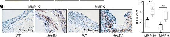 Remodeled ECM enhances the invasive behaviors of ovarian cancer cells. (a) H&E stain of the tumor lesions from WT and ApoE−/− mice at two weeks post ID8 engraftment (left). Graph represents the mean size of the lesions calculated from ten random fields (right). (b) Masson’s Trichrome stain of tumor lesions (left). The mean percentage of positive regions in ten random fields was calculated (right). (c) The cytokines/chemokines profile in the supernatants of ascites from WT and ApoE−/− mice. Four groups of mouse cytokine dot-blot arrays are shown. Dot-blots with significant changes are shown in boxed areas (red). (d) The top four pathways enriched among the molecules with significant changes using KEGG pathway analysis. (e) MMP-10 and MMP-9 protein expression in tumor lesions, determined by blinded IHC analysis (left). Box plot of the IHC score of MMP-10 and MMP-9 (right). Box represents the 25th–75th percentile while whiskers indicate the 5th–95th percentile. The black box represents tumor lesions from WT mice and the grey box represents tumor lesions from ApoE−/− mice. Each experiment included data from 5 mice. Bar represents 50 μm. *P < 0.05; **P < 0.005 Image collected and cropped by CiteAb from the following publication (//pubmed.ncbi.nlm.nih.gov/29458390), licensed under a CC-BY license. Not internally tested by R&D Systems.