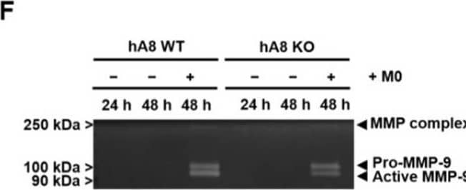 Western Blot MMP-9 Antibody [Unconjugated]