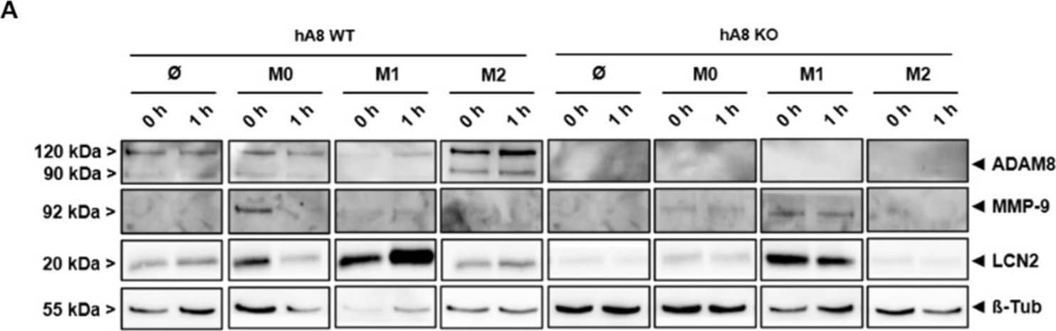 Western Blot MMP-9 Antibody [Unconjugated]