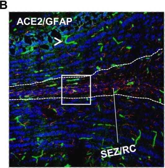 Distribution of ACE2 along the olfactory retrograde route. A Schematic elucidation of a gross view of mouse olfactory retrograde route comprised by OB surface, SEZ/RC, SEZ in the rostral migratory stream (SEZ/RMS) and SVZ of the LV (top panel) and a microscopic view of SEZ/RC and SEZ/RMS (bottom panel). B–E Co-staining of ACE2 (green) with astrocyte marker GFAP (red) in SEZ/RC and SEZ/RMS. B-C show the low magnitude images. D–E show the enlarged images of the indicated regions in B and C, respectively. DAPI (blue) was used for nuclear staining. Arrow: indicates astrocyte. Dash arrow: indicates neuroblast. Arrowhead: indicates microvessel. The dash lines in all images outline the border of SEZ/RC and SEZ/RMS, respectively. Image magnitude B-C: 20X, D-E: 100X Image collected and cropped by CiteAb from the following open publication (//pubmed.ncbi.nlm.nih.gov/35672716), licensed under a CC-BY license. Not internally tested by R&D Systems.