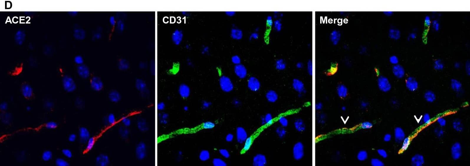 Ubiquitous expression of ACE2 in cerebral microvascular pericytes. A Schematic elucidation of sectioning plates and main brain regions of a mouse brain. OB: olfactory bulb, SEZ/RC: subependymal zone (SEZ) in the rhinocele, CTX: cerebral cortex, CC: corpus callosum, STR: striatum, LV: lateral ventricle, HP: hippocampus, TH: thalamus, 3 V: third ventricle, HY: hypothalamus, AQ: cerebral aqueduct, MB: midbrain, CB: cerebellum, 4 V: fourth ventricle, MY: medulla oblongata. B Scanning images show ACE2 (green) distribution in the hemisphere sections. C–F ACE2 (red) ubiquitously distributes in the cerebral microvessels labeled by endothelial cell marker CD31 (green) and pericyte marker PDGFR beta  (green), respectively. ACE2 overlapped with pericyte marker PDGFR beta  (F) but not endothelial cell marker CD31 (D). C and E showed the low magnitude images. D and F showed the enlarged images of the indicated regions in C and E, respectively. G ACE2 (red) does not distribute in large blood vessels marked by CD31 (green) but is detectable in the meninges wrapping HY. DAPI (blue) was used for nuclear staining. *: indicates large blood vessels. #: indicates meninges. Arrowhead: indicates microvessel. Image magnitude B: 10X; C, E and G: 20X; D and F: 100X Image collected and cropped by CiteAb from the following open publication (//pubmed.ncbi.nlm.nih.gov/35672716), licensed under a CC-BY license. Not internally tested by R&D Systems.