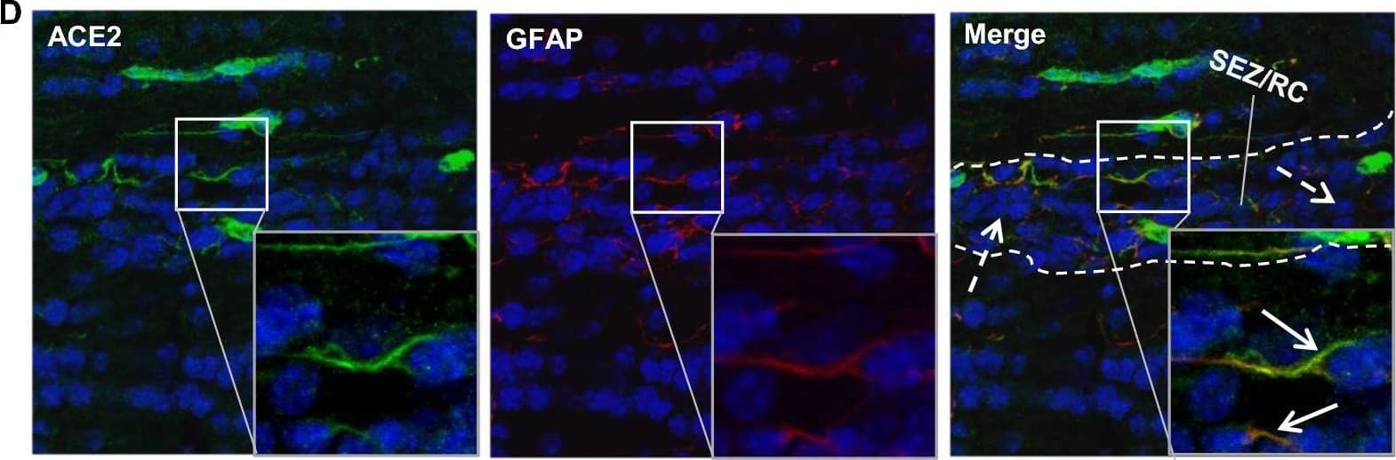 Distribution of ACE2 along the olfactory retrograde route. A Schematic elucidation of a gross view of mouse olfactory retrograde route comprised by OB surface, SEZ/RC, SEZ in the rostral migratory stream (SEZ/RMS) and SVZ of the LV (top panel) and a microscopic view of SEZ/RC and SEZ/RMS (bottom panel). B–E Co-staining of ACE2 (green) with astrocyte marker GFAP (red) in SEZ/RC and SEZ/RMS. B-C show the low magnitude images. D–E show the enlarged images of the indicated regions in B and C, respectively. DAPI (blue) was used for nuclear staining. Arrow: indicates astrocyte. Dash arrow: indicates neuroblast. Arrowhead: indicates microvessel. The dash lines in all images outline the border of SEZ/RC and SEZ/RMS, respectively. Image magnitude B-C: 20X, D-E: 100X Image collected and cropped by CiteAb from the following open publication (//pubmed.ncbi.nlm.nih.gov/35672716), licensed under a CC-BY license. Not internally tested by R&D Systems.