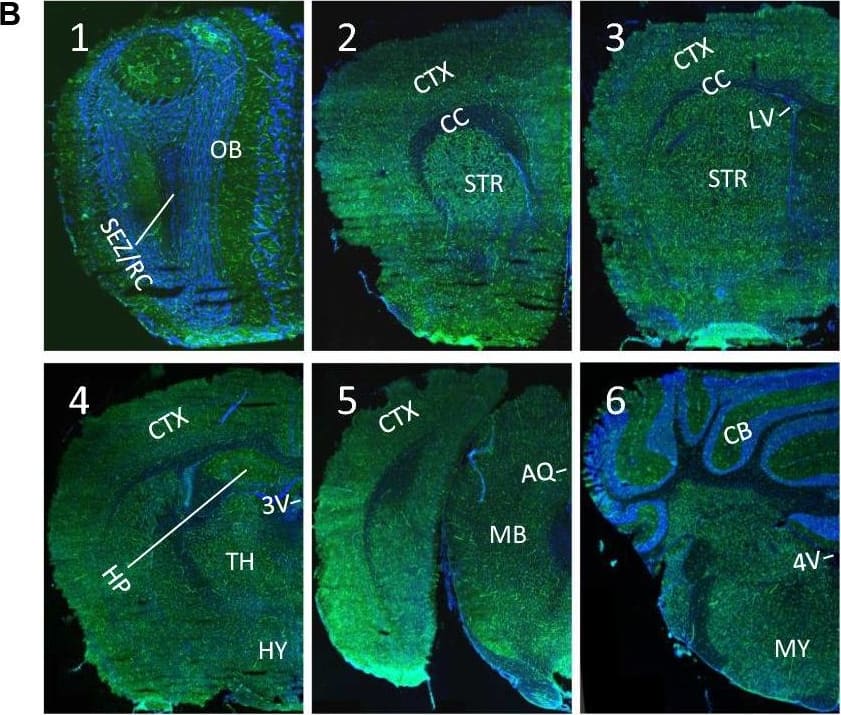 Ubiquitous expression of ACE2 in cerebral microvascular pericytes. A Schematic elucidation of sectioning plates and main brain regions of a mouse brain. OB: olfactory bulb, SEZ/RC: subependymal zone (SEZ) in the rhinocele, CTX: cerebral cortex, CC: corpus callosum, STR: striatum, LV: lateral ventricle, HP: hippocampus, TH: thalamus, 3 V: third ventricle, HY: hypothalamus, AQ: cerebral aqueduct, MB: midbrain, CB: cerebellum, 4 V: fourth ventricle, MY: medulla oblongata. B Scanning images show ACE2 (green) distribution in the hemisphere sections. C–F ACE2 (red) ubiquitously distributes in the cerebral microvessels labeled by endothelial cell marker CD31 (green) and pericyte marker PDGFR beta  (green), respectively. ACE2 overlapped with pericyte marker PDGFR beta  (F) but not endothelial cell marker CD31 (D). C and E showed the low magnitude images. D and F showed the enlarged images of the indicated regions in C and E, respectively. G ACE2 (red) does not distribute in large blood vessels marked by CD31 (green) but is detectable in the meninges wrapping HY. DAPI (blue) was used for nuclear staining. *: indicates large blood vessels. #: indicates meninges. Arrowhead: indicates microvessel. Image magnitude B: 10X; C, E and G: 20X; D and F: 100X Image collected and cropped by CiteAb from the following open publication (//pubmed.ncbi.nlm.nih.gov/35672716), licensed under a CC-BY license. Not internally tested by R&D Systems.